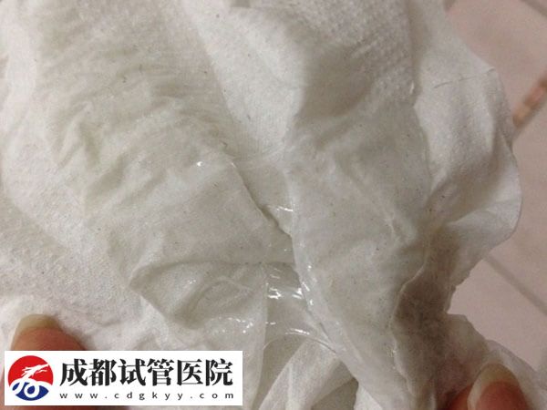 孕晚期分泌物多是男孩还是女孩(图1)